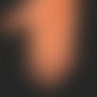 Pityriasis rubra pilaris (a... Pityriasis rubra pilaris (adulter Typ): zum Handgelenk hin scharf abgesetzte (Unterschied zum hy...