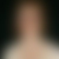 Pityriasis rubra pilaris (a... Pityriasis rubra pilaris (adulter Typ): Flächige, pityriasiform schuppende gelb-rötliche, scharf...