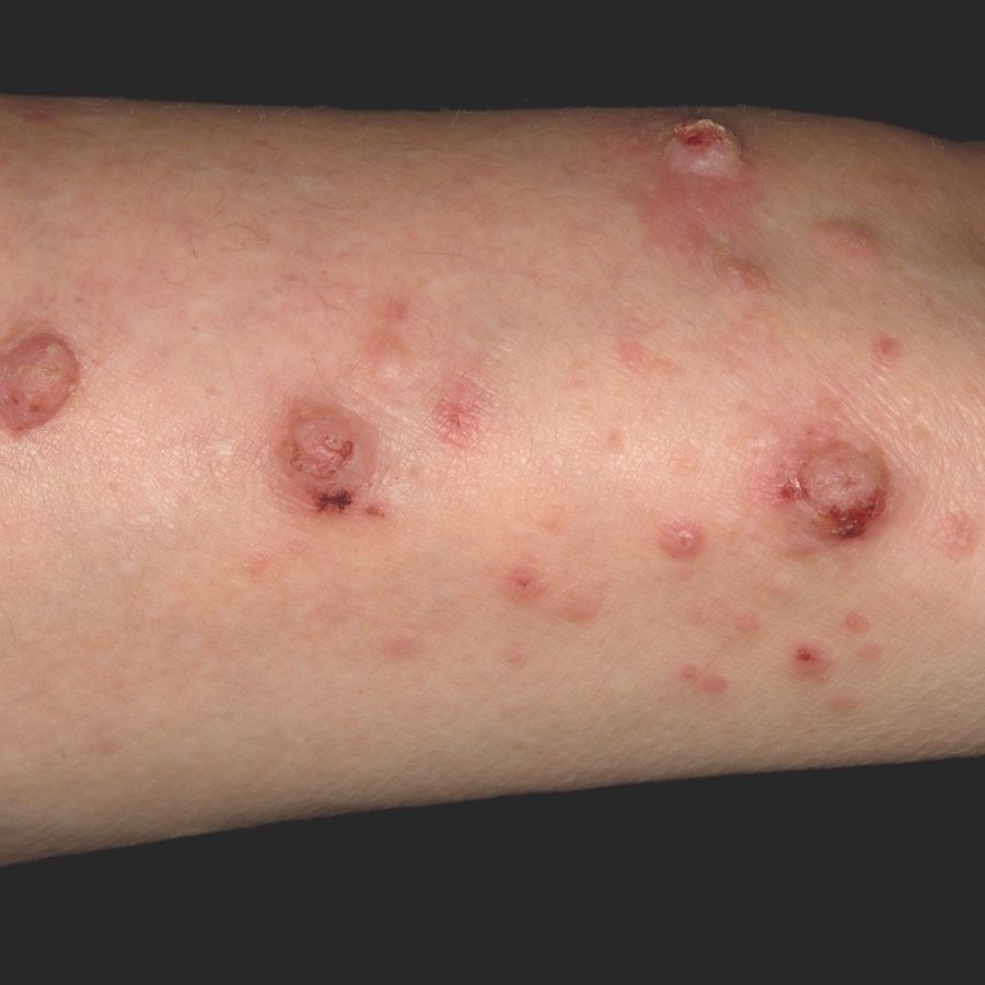 Pharmaceris Puri-Rosalgin Seifenfrei D-Panthenol Pharmaceris R  Puri-Rosalgin Gesichtswaschgel | Für Rosacea-Haut | Mit D-Panthenol 200ml  D-Panthenol Gesichtswaschgel, image size:900x900