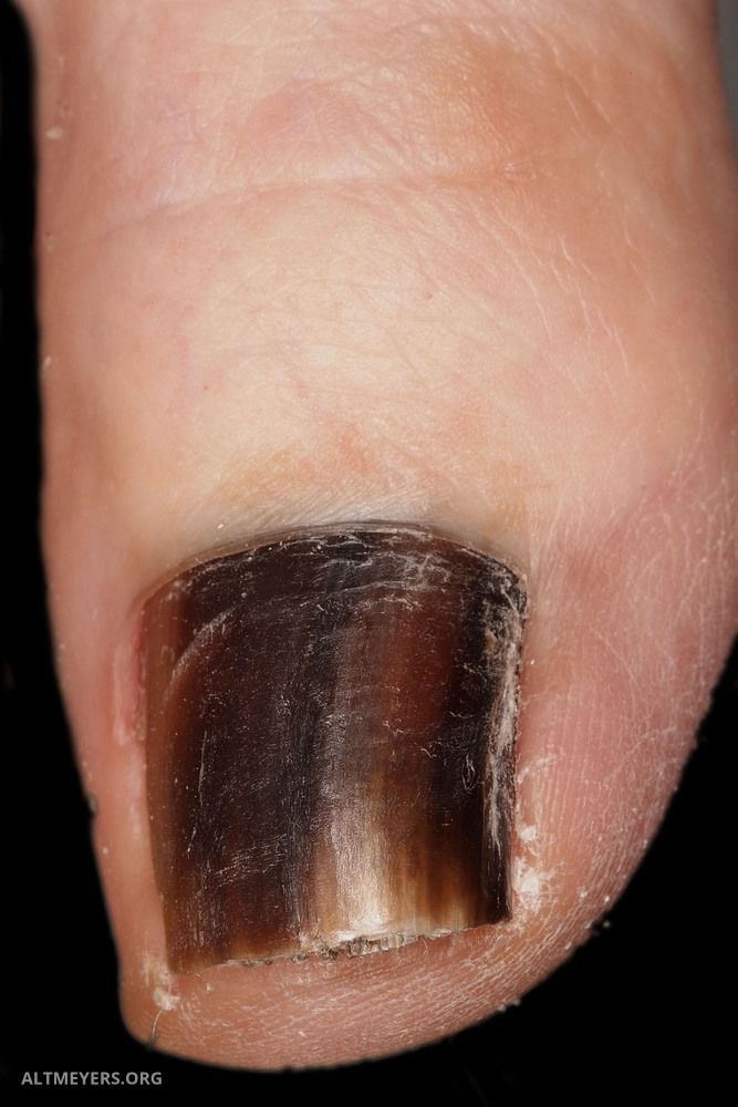 Bedeutung schwarzer nagellack Schwarzer nagellack