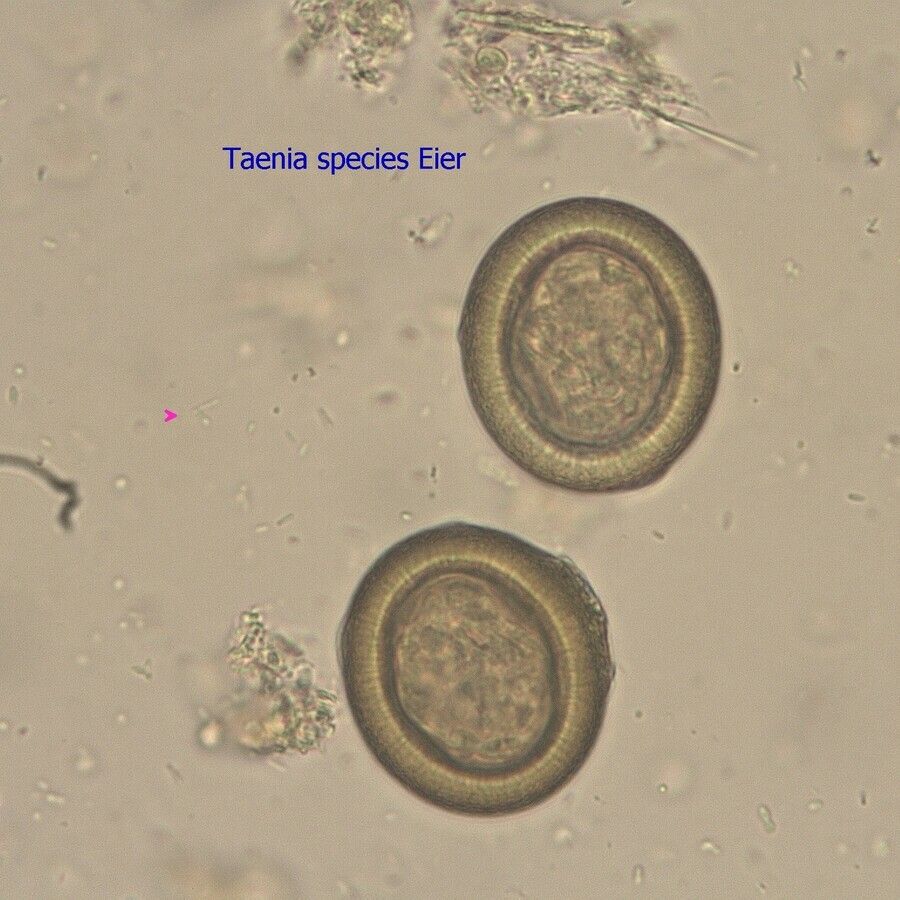 Taenia Solium Egg