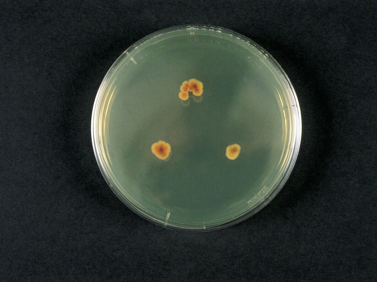 Superficial tinea capitis - Altmeyers Encyclopedia - Department Dermatology