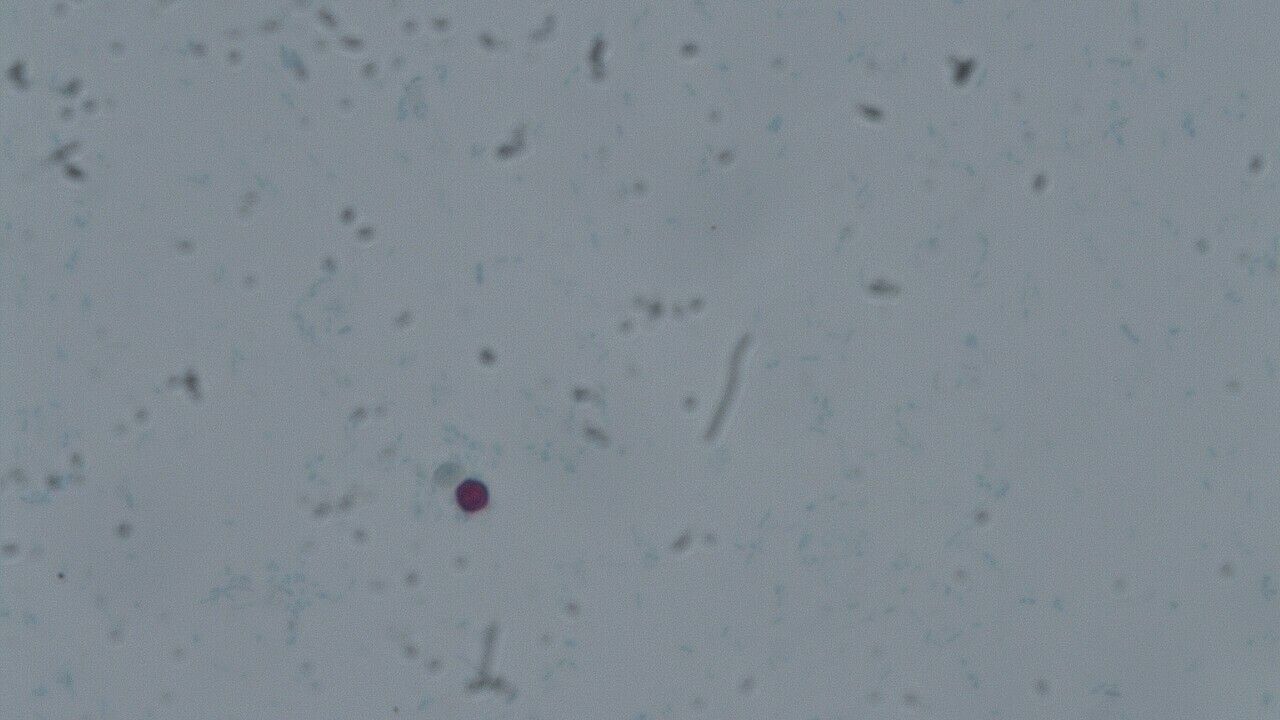 Diagnostik: Parasitologie