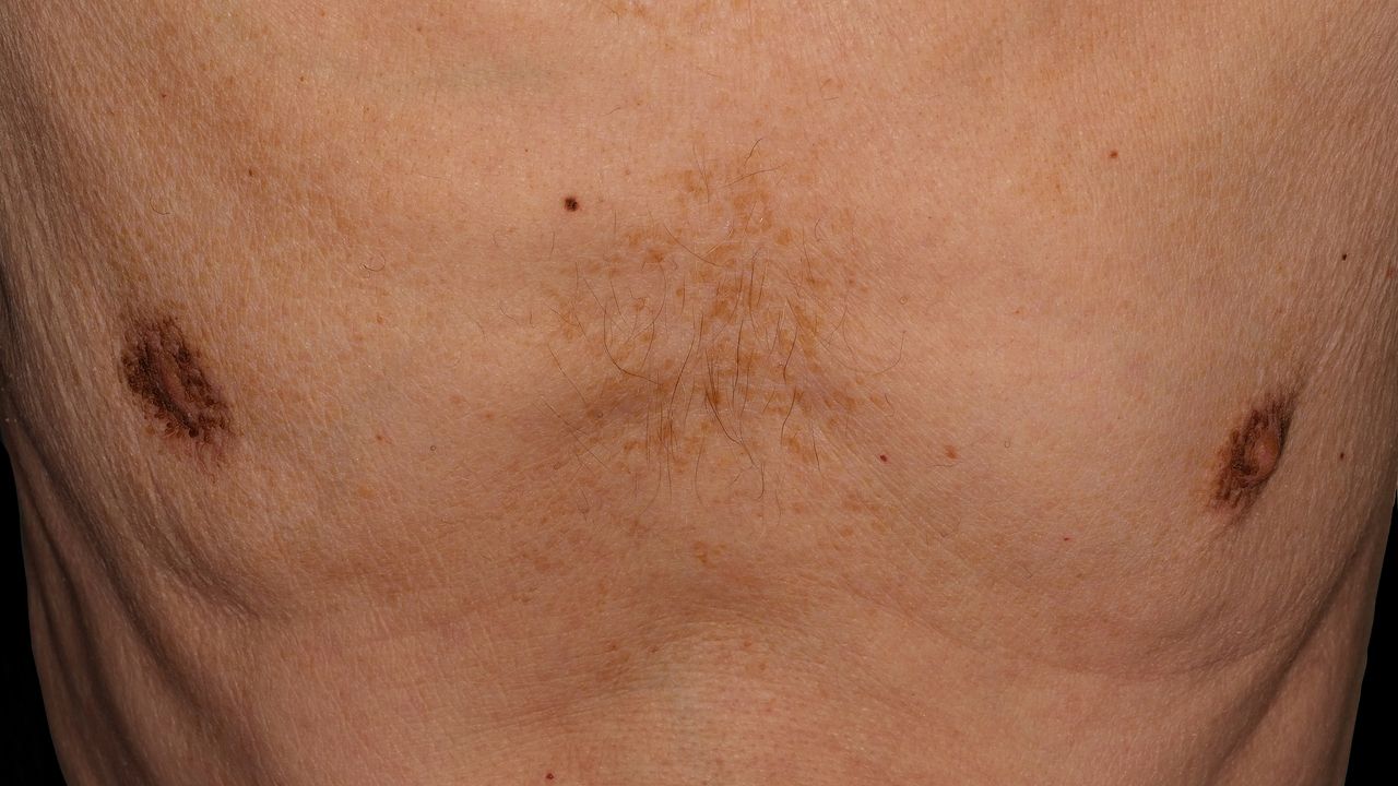 Yalangoch Doro Pesch fotosurati Ayollar bilan jinsiy aloqada bolgan transseksuallarni tomosha qiling