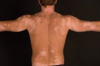 what is lipo c peptide used for Lipo-C Peptide: Complete Guide to Fat-Burning Lipotropic Injections