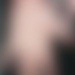Erythrokeratodermia progressiva symmetrica: diffuse Keratosis palmaris. Abb entnommen aus: Verma ...