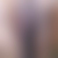 Pemphigoid vegetans: 9-jähr... Pemphigoid vegetans: 9-jähriges Mädchen mit rezdivierenden, verrukösen Plaques der Vulva. Abheilu...