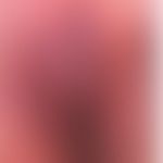 Pemphigoid vegetans: 9-jähriges Mädchen mit rezdivierenden, verrukösen Plaques der Vulva. Abb.ent...