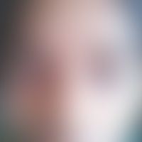 Pemphigoid vegetans: 9-jähr... Pemphigoid vegetans: 9-jähriges Mädchenm mit rezdivierenden, eitrigen, vegetierenden Plaques im G...