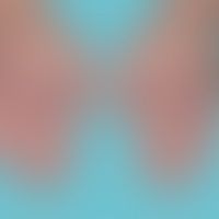 Erythema elevatum diutinum: Seit mehreren Monaten, schmerzlose erythematöse Plaques und Knoten. A...