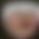 Syphilis/Primäraffekt: Historische Moulage. Abbildung entnommen aus: K. Zieler, Atlas der Haut- u...