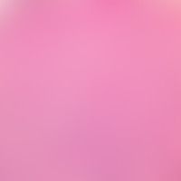Chronisch rezidivierende an... Chronisch rezidivierende anuläre neutrophile Dermatose: Dichte überwiegend neutrophile Infiltrati...