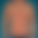 Dyskeratosis follicularis: randbetonte entzünldiceh Plaque- Abb. entnommen aus: Dorf IL et al. (2...