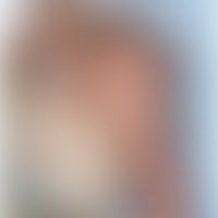 Histiozytose intralymphatis... Histiozytose intralymphatische: Asymptomatische, streifige und flächenhafte rote und bräunliche F...