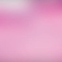 Acrodermatitis enteropathica: breite Akanthose, Hyper- und Parakeratose, schütteres Infitlrat in ...