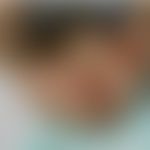 Acrodermatitis enteropathica: chronische, ekzematöse Läsionen. S. Köbner-Phänomene. Abb. entnomme...