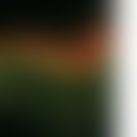 Pemphigus foliaceus, endemi... Pemphigus foliaceus, endemischer: Bei aktiver Erkrankung immer nachweisbare Ablagerungen von IgG ...
