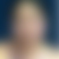 Pemphigus foliaceus, endemi... Pemphigus foliaceus, endemischer: Lokalisierte Form der Erkrankung mit blättriger Abschuppung und...