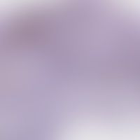 Xanthom verruziformes: Nach... Xanthom verruziformes: Nachweis von CD68 in den schaumigen Zellen der Hautpapillen