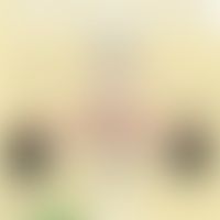 Übersicht über die Zellkontakte der Epidermis. Abb mit Hilfe der KI erstellt.   
