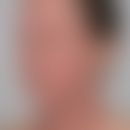 Atopische Head-and-Neck-Dermatitis: schwere disseminierte Ekzemreaktion an Gesichts- und Halspart...