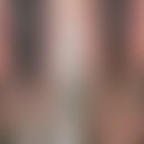CTLA-4-Haploinsuffizienz: s... CTLA-4-Haploinsuffizienz: schwere atopische Dermatitis mit Befall der Extremitäten (Abb. entnomme...