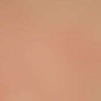 Differenzialdiagnose: Immun... Differenzialdiagnose: Immunrekonstitutions-Follikulitis
Diagnose: Malassezia-Follikulitis. Dis...