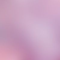Immunrekonstitutions-Follik... Immunrekonstitutions-Follikulitis: gemischtezllige, überwiegend neutrophile Follikulitis, wenige ...