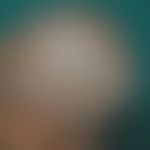 Infektion: Nicht vernarbend... Infektion: Nicht vernarbende Alopezie/Haarabbrüche durch Infektion mit einer Mikrosporum-Art (s.u...