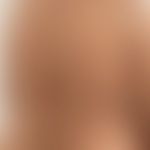 Grinspan-Syndrom: Klinische Zeichen des Pemphigus vulgaris. Abb. entnommen aus: Saddik A et al. 2...