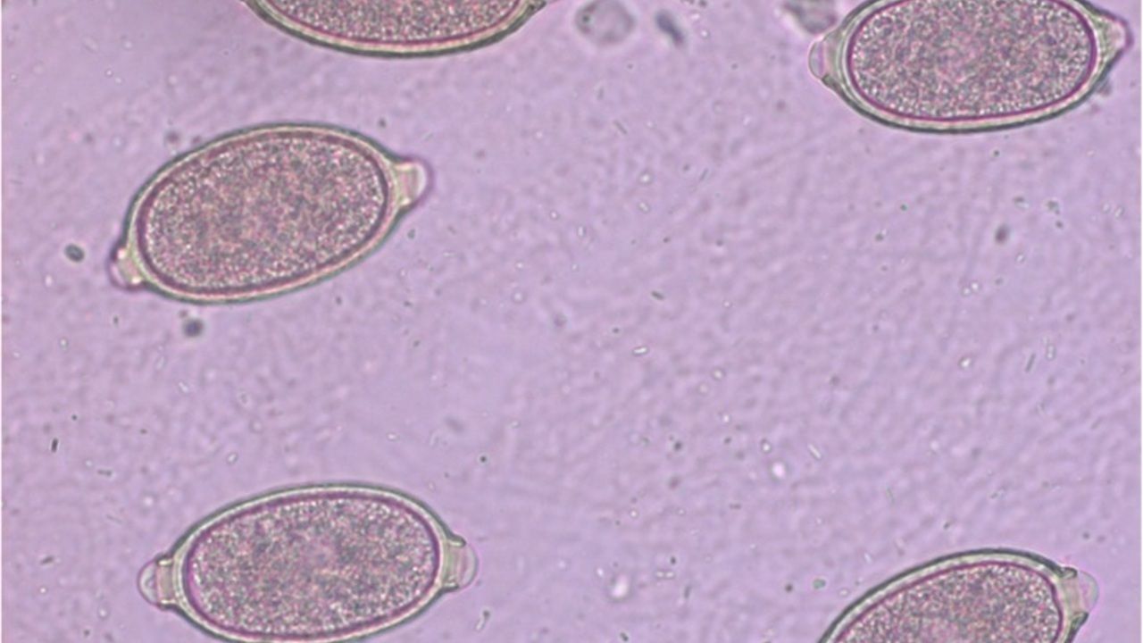 Capillaria Hepatica Egg