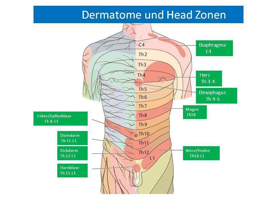 HEADZONE