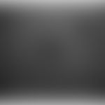 Roth-Flecken: Das Fundus-Autofluoreszenzbild zeigt Bereiche mit blockiertem Signal aufgrund der d...