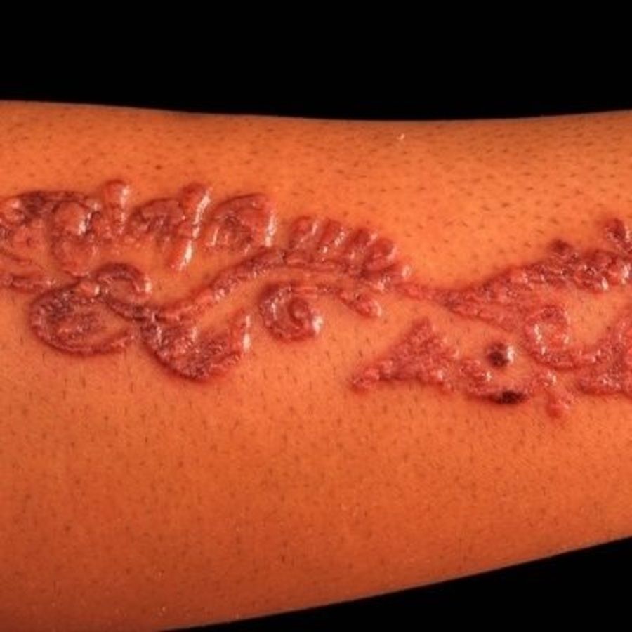Tattoo infection: Symptoms, treatment, and prevention, image size:900x900